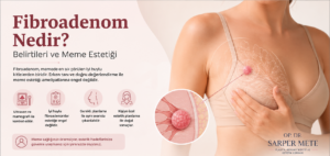 Fibroadenom nedir? Meme estetiği planlanan hastalarda fibroadenomun değerlendirilmesi hakkında bilgilendirici görsel.