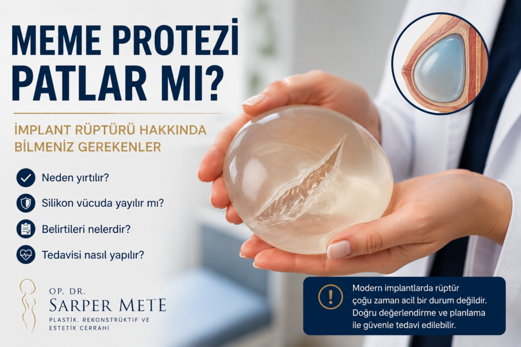 Meme protezi patlar mı? Modern meme implantlarında rüptür, belirtileri ve tedavisi hakkında bilgilendirici görsel.