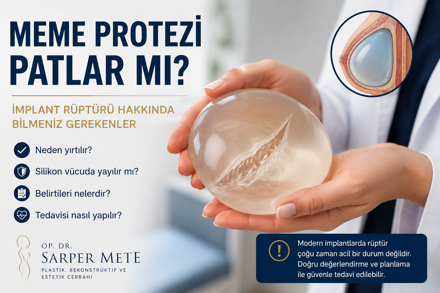 Meme Protezi Patlar mı? İmplant Rüptürü Hakkında Bilmeniz Gerekenler